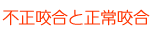 不正咬合と正常咬合